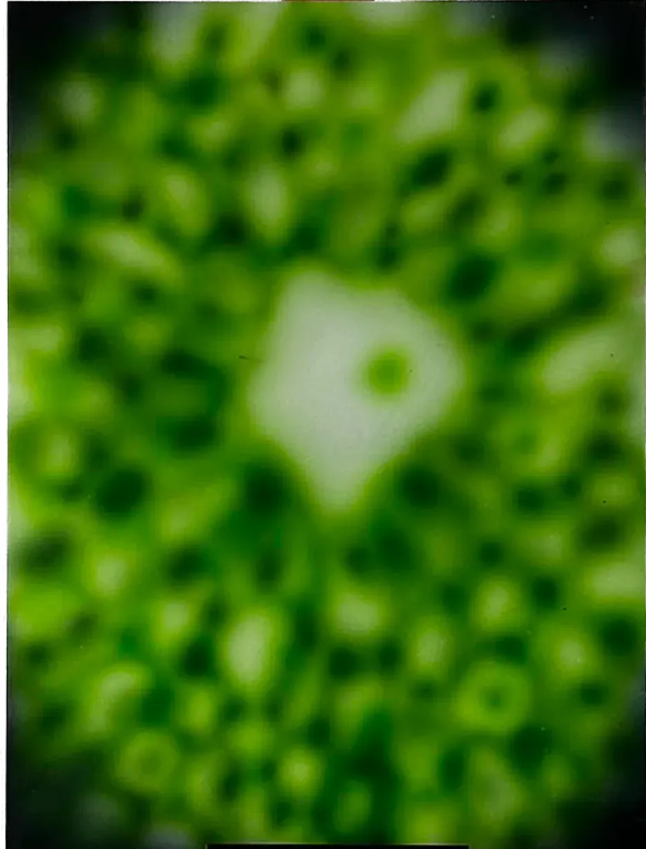 EMBRYO